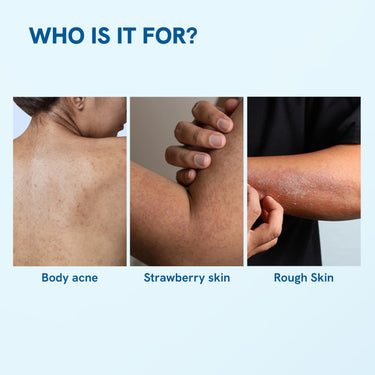 Be Bodywise 1% Salicylic Acid Body Wash 500ml | Helps to Prevent Body Acne & Cleanse Skin | Paraben and SLS free | Pack of 2